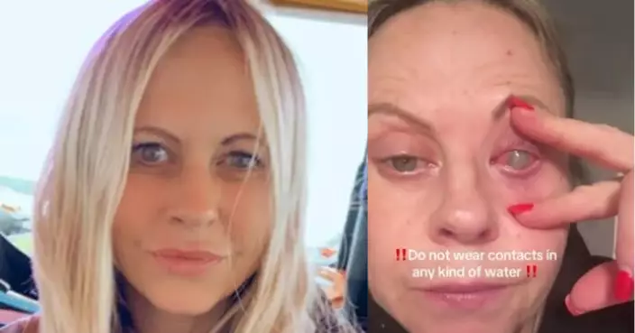 清理馬廄跌入泥水 英女未摘隱形眼鏡洗臉染罕見角膜炎右眼失明