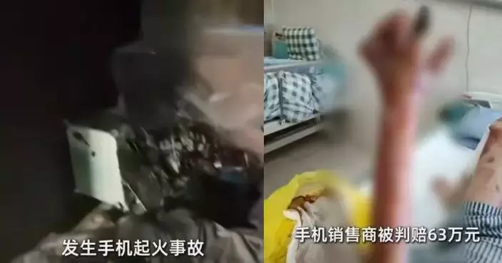 邊充電邊滑手機瞓著釀火災 東莞女全身燒傷10指全毀 法院判自負4成責任