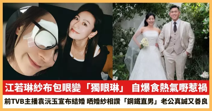 【2026.7.6娛圈熱點】江若琳紗布包眼變「獨眼琳」 前TVB主播袁沅玉宣布結婚