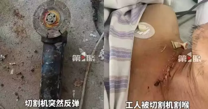 遭切割機反彈割喉 內地水電工頸內靜脈幾乎全斷獲工友即時壓迫止血保命