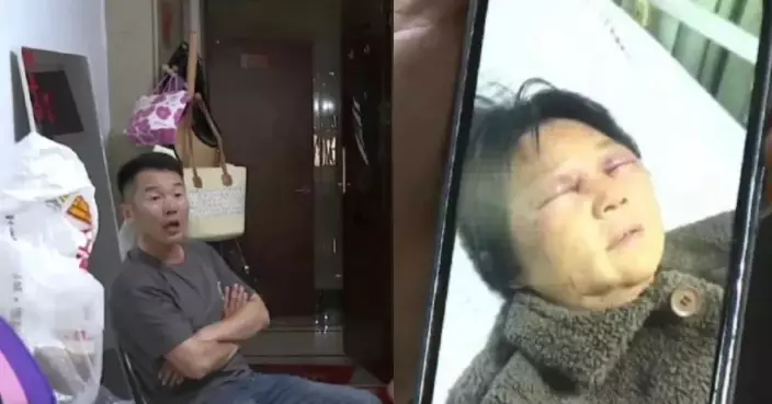 浙江婦拒幫湊孫遭新抱毆打4條肋骨斷裂 兒子未制止反盲撐「情有可原」
