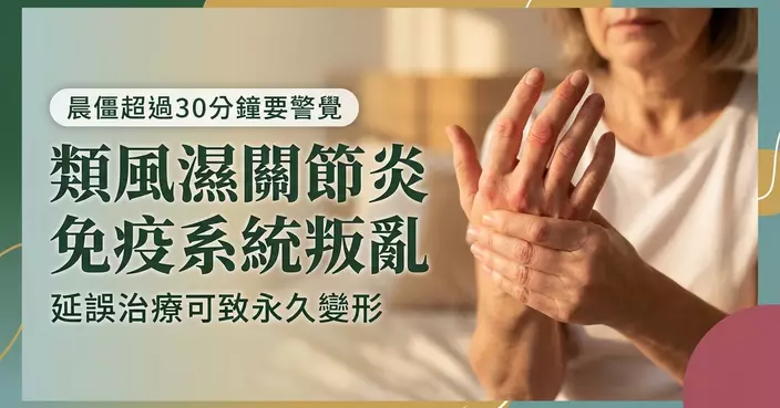 晨僵以為年紀大，其實類風濕關節炎？