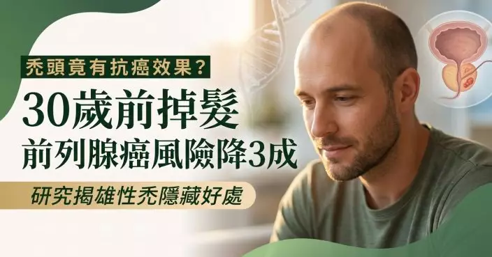 雄性禿意外藏好處！研究揭：男性30歲前掉髮「1患癌風險降3成」