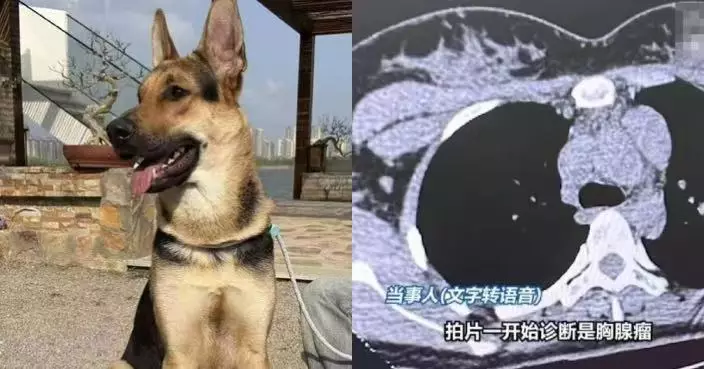 遭40KG愛犬撲撞踩斷肋骨 北京女求醫意外揭罹患罕見病 幸及早切除未擴散
