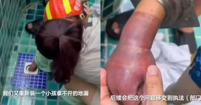 內地男童戲水手臂遭排水口強吸嚴重紅腫瘀血 三亞民宿：自行掀蓋所致！