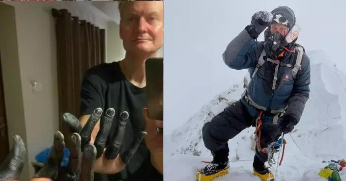 登頂馬卡魯峰後遭嚮導拋下海拔7,900米處昏迷 俄登山客左手嚴重凍傷5指需截肢