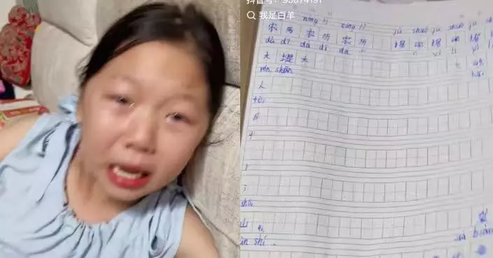 用可擦筆寫完暑期功課被哥哥的即食麵「燙沒」 河南女童崩潰獲網民教1招救回