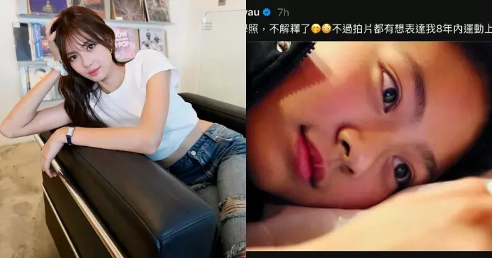 游嘉欣持續被質疑整容 晒中學舊照證從細靚到大：不解釋了