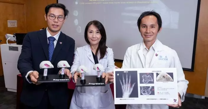 中大醫學院首創HR-pQCT技術 精準分辨類風濕關節炎直正病變