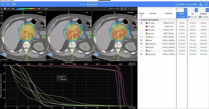 Radformation OptiPlan獲FDA擴大許可 自動化VMAT規劃美國應用