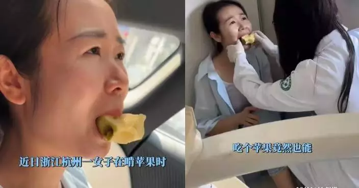 大口咬蘋果突聞「啪」聲 杭州女半個蘋果卡嘴內無法取出 求醫揭下巴脫臼
