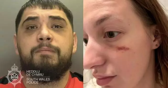 英3孩母長期遭前男友家暴 被打甩牙遭狗繩鞭打 施暴者囚34個月恐提早獲釋