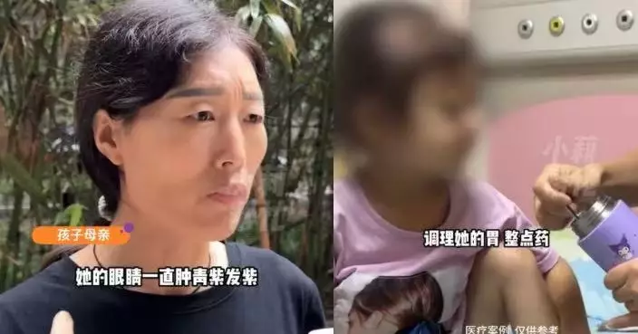 河南4歲女童突現「熊貓眼」被母誤當捱夜玩手機 求醫揭患「兒童癌王」
