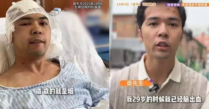 長期抽煙喝酒突發嚴重腦出血 河南29歲男開顱撿回一命悔悟：年輕不是本錢！