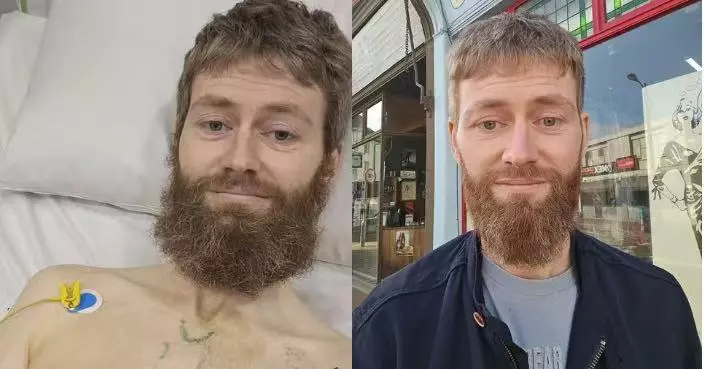 訓練期間突心臟驟停 英國馬拉松跑手獲跑友即場施救挽回一命 求醫揭急性心肌炎