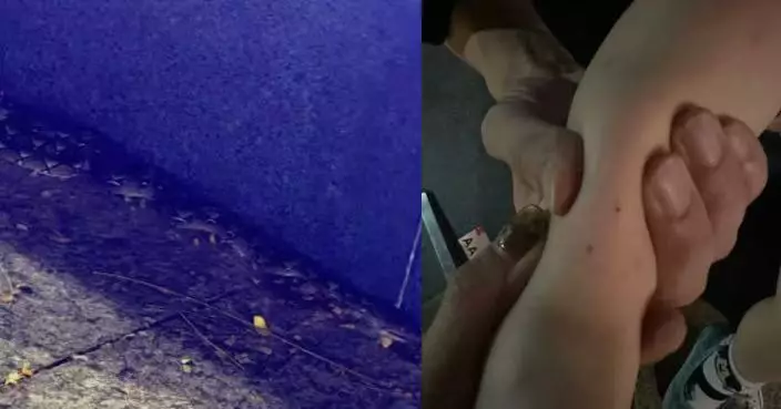 內地2歲女童新加坡景區散步遭蛇咬 腳踝紅腫送院治理 幸蛇隻無毒