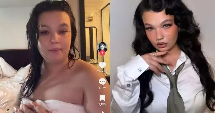自爆長年吸電子煙曾一度呼吸困難 英國女歌手台上暈倒後決心戒煙