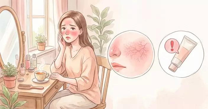 面紅紅，玫瑰痤瘡誤當敏感