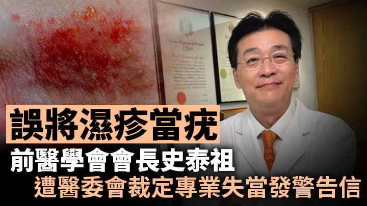 誤將濕疹當疣,前醫學會會長史泰祖遭醫委會裁定專業失當發警告信。